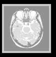 2D image of a brain.