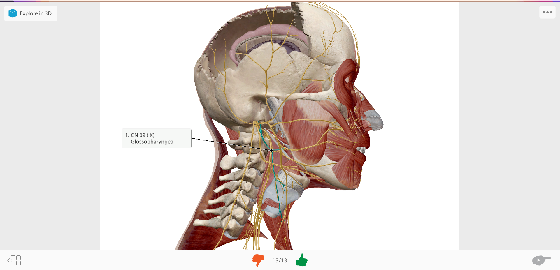 Example flashcard for CN 09 (X) Glossopharyngeal.