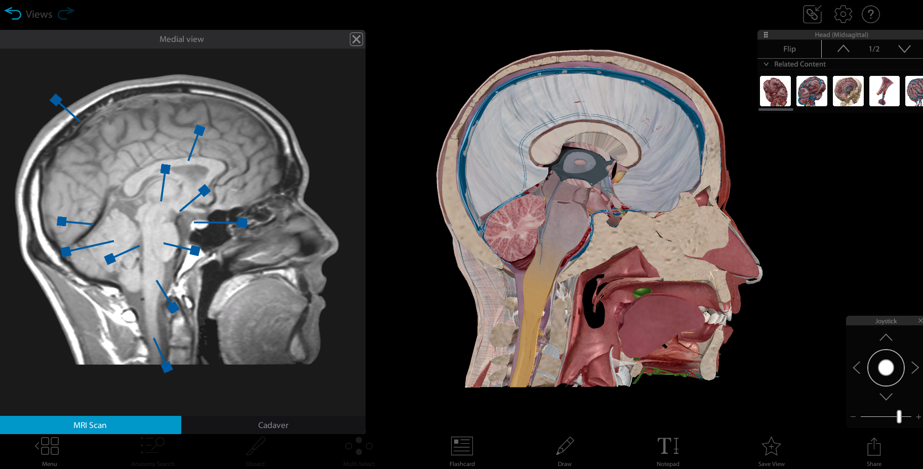 A cross section of a head.